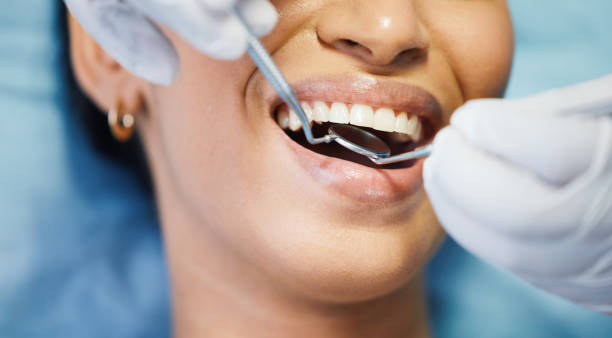 Best Emergency Tooth Extraction in Glandorf, OH