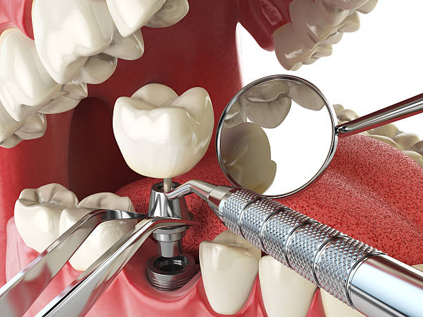 Best Same-Day Emergency Dental Services in Glandorf, OH